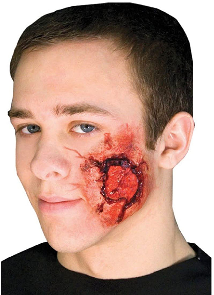 Ez Fx Open Wound Kit - CSEZ165